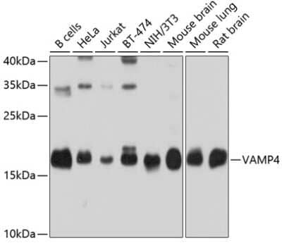 Western Blot: VAMP4 AntibodyBSA Free [NBP2-94885]