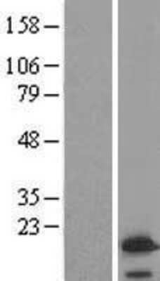 Western Blot: VAMP4 Overexpression Lysate [NBL1-17689]