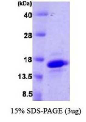 SDS-PAGE: Recombinant Human VAMP4 His Protein [NBP1-30191]