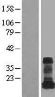 Western Blot: VAMP-5 Overexpression Lysate [NBL1-17690]