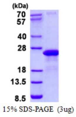 SDS-PAGE: Recombinant Human VAMP-7 His Protein [NBP2-22939]