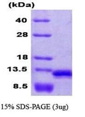 SDS-PAGE: Recombinant Human VAMP-8 His Protein [NBC1-18348]