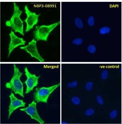 Immunocytochemistry/ Immunofluorescence: VAP-1/AOC3 Antibody (2D10) - Chimeric - Azide and BSA Free [NBP3-08991]