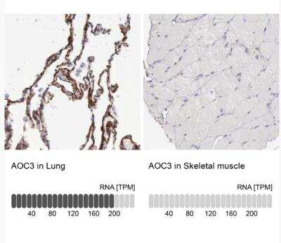 Immunohistochemistry-Paraffin: VAP-1/AOC3 Antibody [NBP1-89671]