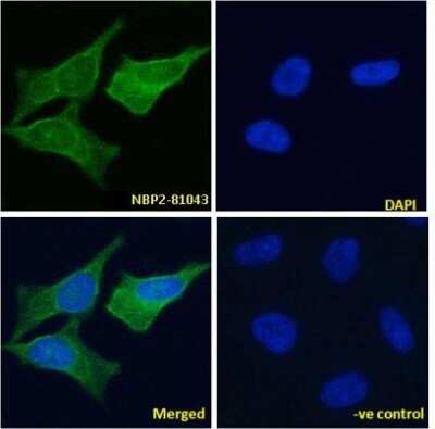 Immunocytochemistry/ Immunofluorescence: VAP-1/AOC3 Antibody (TK8-14) - Chimeric - Azide and BSA Free [NBP2-81043]