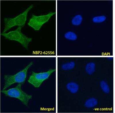 Immunofluorescence: VAP-1/AOC3 Antibody (TK8-14) - Azide and BSA Free [NBP2-62556]