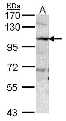 Western Blot: VAP-1/AOC3 Antibody [NBP1-31935]