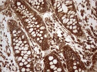 Immunohistochemistry: VAP-A Antibody (OTI10E10) [NBP2-46319]