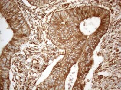 Immunohistochemistry: VAP-A Antibody (OTI10E10) [NBP2-46319]