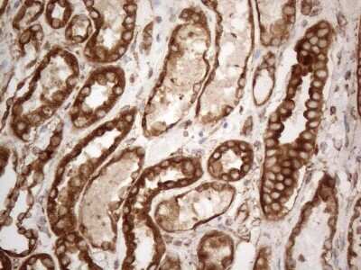 Immunohistochemistry: VAP-A Antibody (OTI10E10) [NBP2-46319]