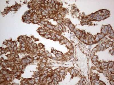 Immunohistochemistry: VAP-A Antibody (OTI10E10) [NBP2-46319]