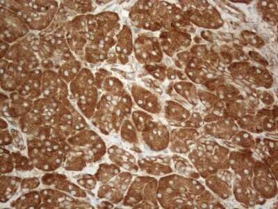 Immunohistochemistry: VAP-A Antibody (OTI10E10) [NBP2-46319]