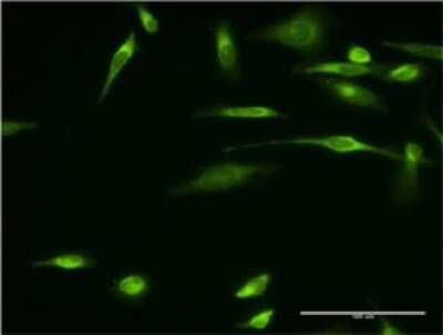Immunocytochemistry/ Immunofluorescence: VAP-A Antibody (4C12) [H00009218-M01]