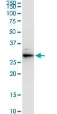 Western Blot: VAP-A Antibody (4C12) [H00009218-M01]
