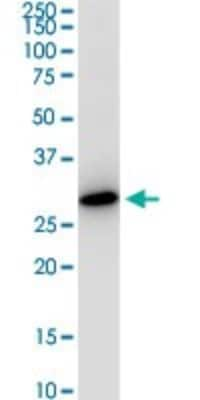 Western Blot: VAP-A Antibody (4C12) [H00009218-M01]