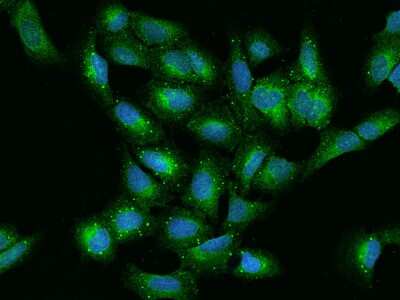 Immunocytochemistry/ Immunofluorescence: VAP-A Antibody [NBP2-97848]