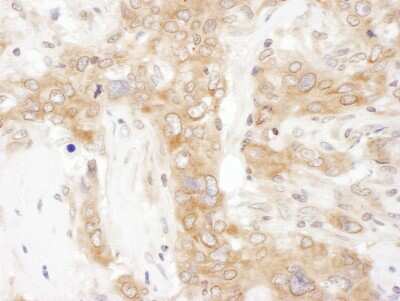 Immunohistochemistry: VAP-A Antibody [NBP2-32249]