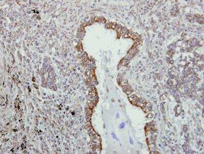 Immunohistochemistry-Paraffin: VAP-A Antibody [NBP1-31237]