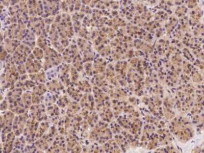 Immunohistochemistry-Paraffin: VAP-A Antibody [NBP2-97848]