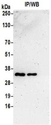 Immunoprecipitation: VAP-A Antibody [NBP2-32249]