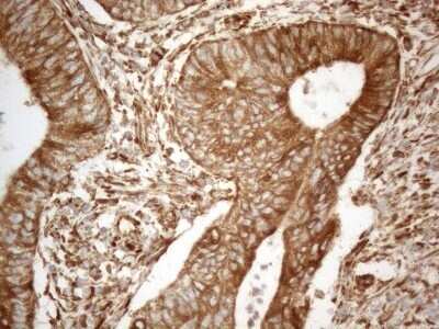 Immunohistochemistry: VAP-A Antibody (OTI10E10) - Azide and BSA Free [NBP2-74825]