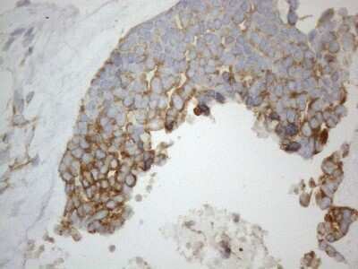 Immunohistochemistry: VAP-A Antibody (OTI10E10) - Azide and BSA Free [NBP2-74825]