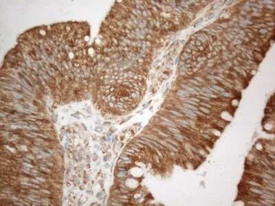 Immunohistochemistry: VAP-A Antibody (OTI10E10) - Azide and BSA Free [NBP2-74825]