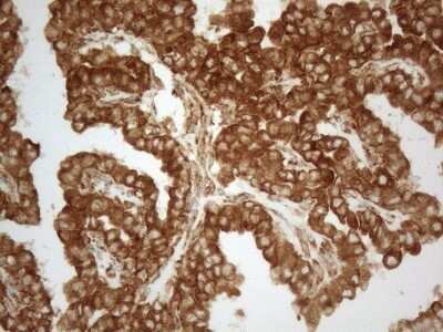 Immunohistochemistry: VAP-A Antibody (OTI10E10) - Azide and BSA Free [NBP2-74825]