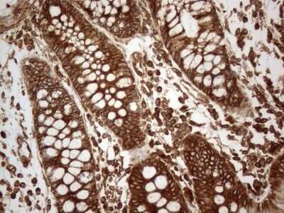 Immunohistochemistry: VAP-A Antibody (OTI10E10) - Azide and BSA Free [NBP2-74825]