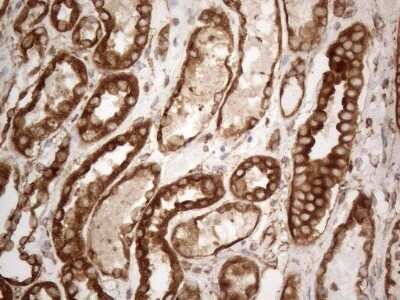 Immunohistochemistry: VAP-A Antibody (OTI10E10) - Azide and BSA Free [NBP2-74825]