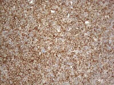Immunohistochemistry: VAP-A Antibody (OTI10E10) - Azide and BSA Free [NBP2-74825]