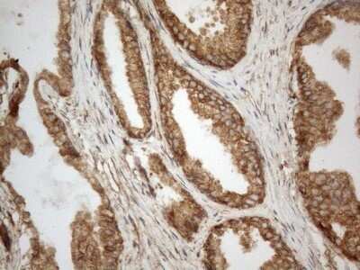 Immunohistochemistry: VAP-A Antibody (OTI10E10) - Azide and BSA Free [NBP2-74825]