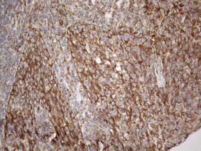 Immunohistochemistry: VAP-A Antibody (OTI10E10) - Azide and BSA Free [NBP2-74825]