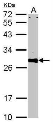 Western Blot: VAP-A Antibody [NBP1-31237]
