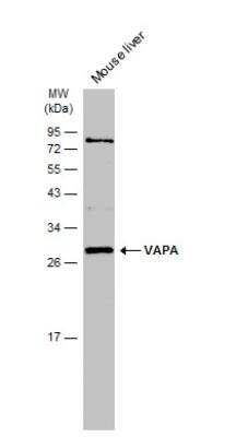 Western Blot: VAP-A Antibody [NBP1-31237]