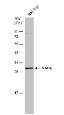 Western Blot: VAP-A Antibody [NBP1-31237]