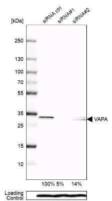 Western Blot: VAP-A Antibody [NBP1-83132]