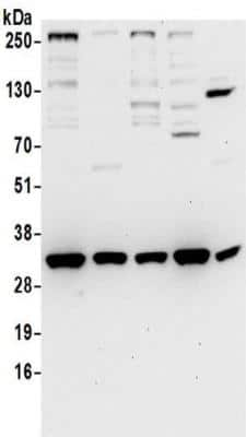 Western Blot: VAP-A Antibody [NBP2-32249]