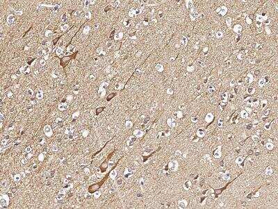 Immunohistochemistry-Paraffin: VAP-B Antibody (103) [NBP2-89625]