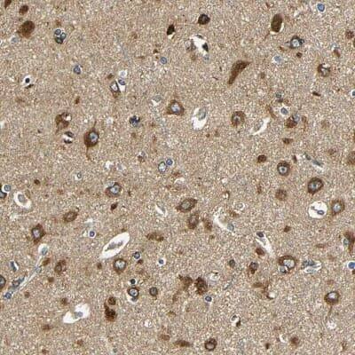 Immunohistochemistry-Paraffin: VAP-B Antibody [NBP1-89112]