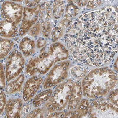 Immunohistochemistry-Paraffin: VAP-B Antibody [NBP1-89112]