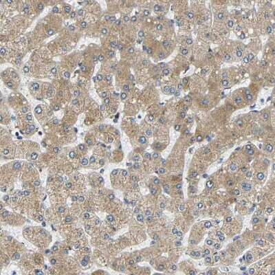 Immunohistochemistry-Paraffin: VAP-B Antibody [NBP1-89112]