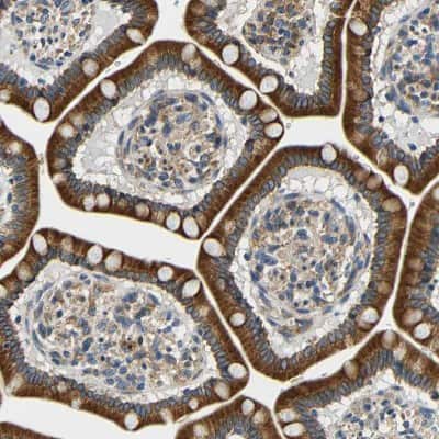 Immunohistochemistry-Paraffin: VAP-B Antibody [NBP1-89112]