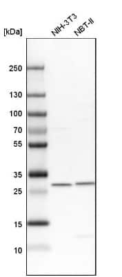 Western Blot: VAP-B Antibody [NBP1-89112]