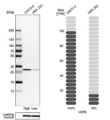 Western Blot: VAP-B Antibody [NBP1-89112]