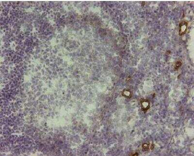 Immunohistochemistry-Paraffin: VAP-1/AOC3 Antibody (174-5) [NBP1-58375]