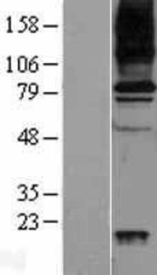 Western Blot: VAP-1/AOC3 Overexpression Lysate [NBP2-04256]