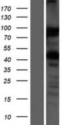 Western Blot: VAP-A Overexpression Lysate [NBP2-09792]