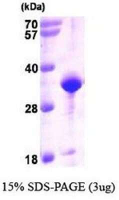 SDS-PAGE: Recombinant Human VAP-A His Protein [NBP1-37090]