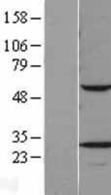 Western Blot: VAP-B Overexpression Lysate [NBL1-17694]